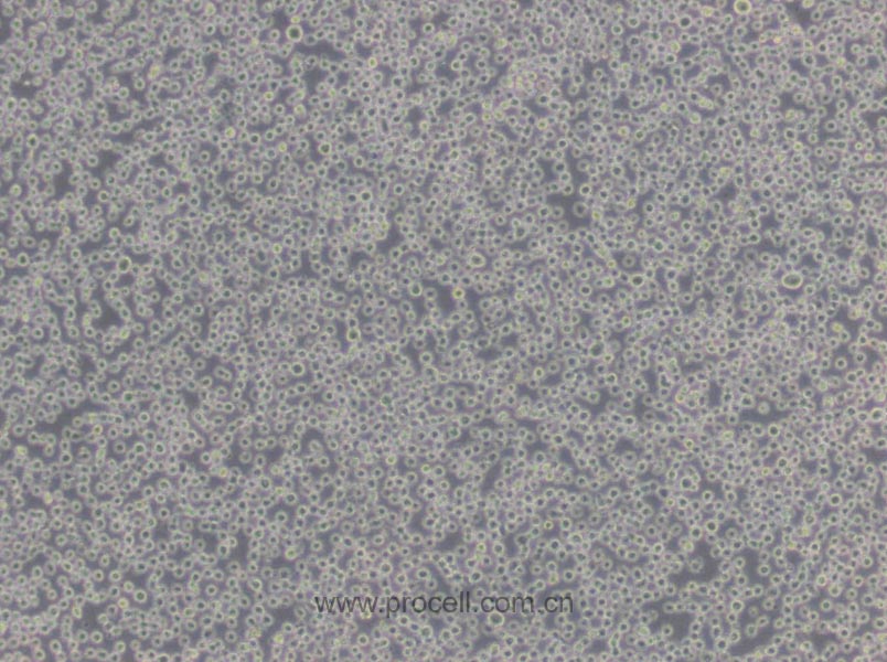 K-562 细胞[K562细胞] (人慢性髓原白血病细胞) (STR鉴定正确)CL-0130