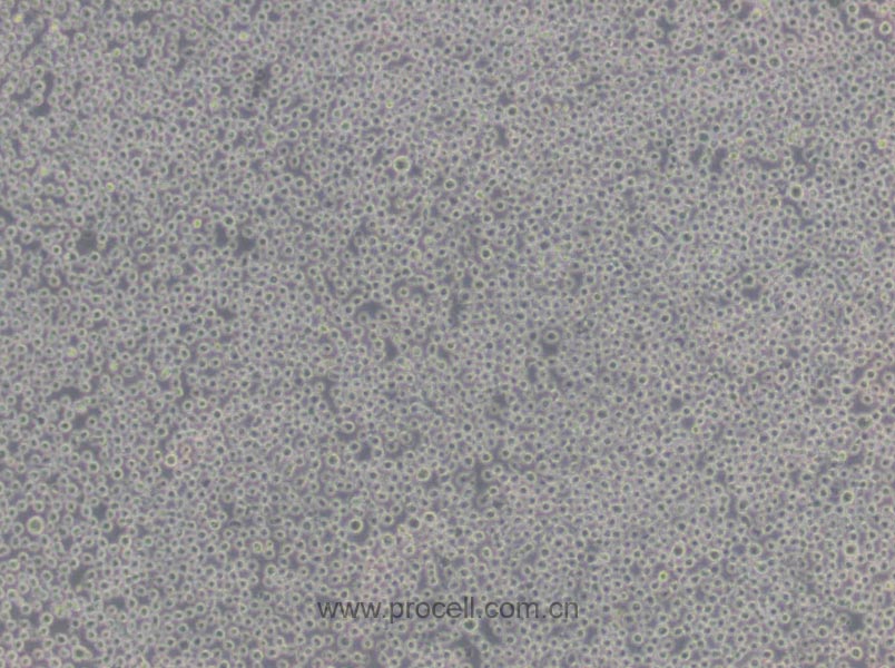 K-562 细胞[K562细胞] (人慢性髓原白血病细胞) (STR鉴定正确)CL-0130