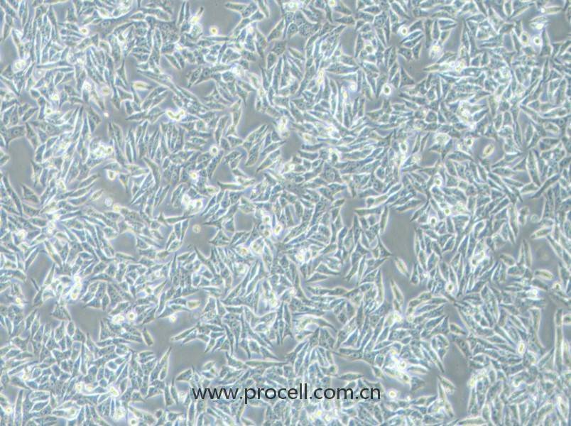 HGC-27细胞 (人胃癌细胞(未分化)) (STR鉴定正确)CL-0107