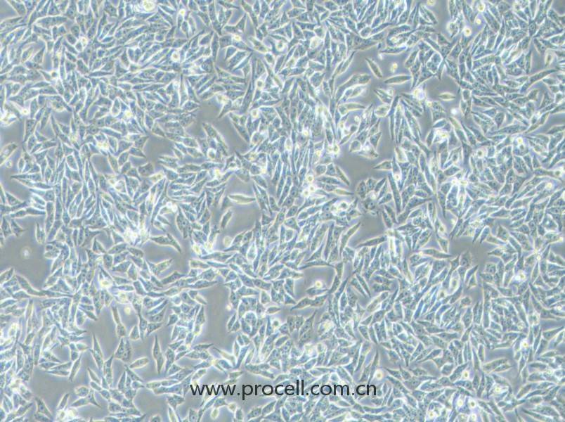 HGC-27细胞 (人胃癌细胞(未分化)) (STR鉴定正确)CL-0107