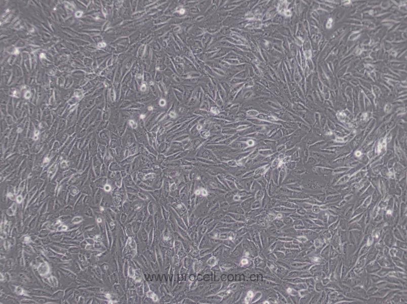 EA.hy926细胞 (人脐静脉细胞融合细胞) (STR鉴定正确)CL-0272