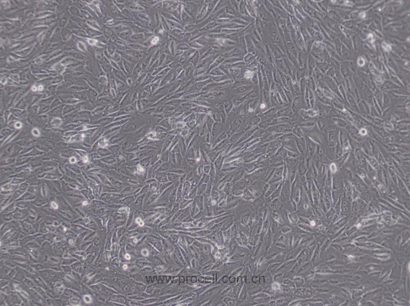 EA.hy926细胞 (人脐静脉细胞融合细胞) (STR鉴定正确)CL-0272