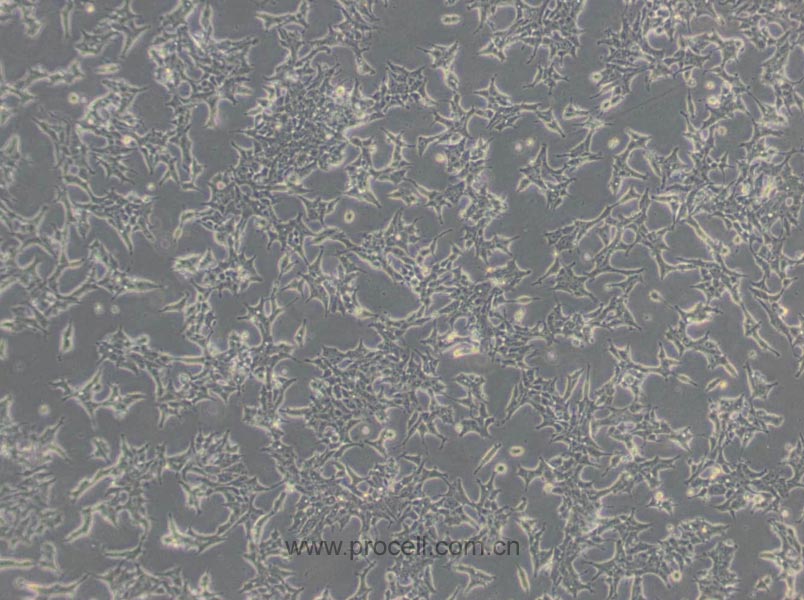 22RV1细胞 (人前列腺癌细胞) (STR鉴定正确)CL-0004