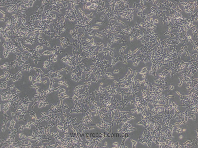 22RV1细胞 (人前列腺癌细胞) (STR鉴定正确)CL-0004