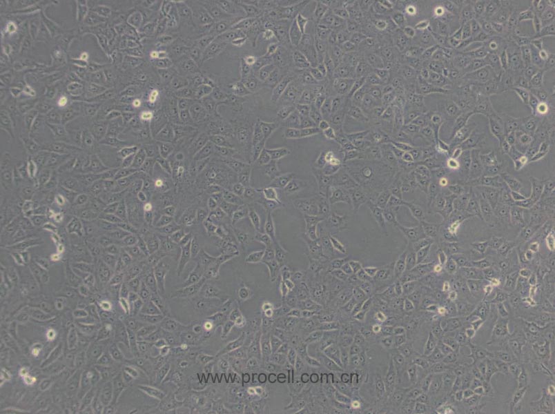 Vero细胞 (非洲绿猴肾细胞)(种属鉴定正确)CL-0242