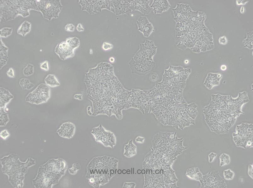 BT-474 细胞[BT474细胞] (人乳腺导管癌细胞) (STR鉴定正确)CL-0040