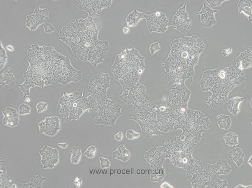 BT-474 细胞[BT474细胞] (人乳腺导管癌细胞) (STR鉴定正确)CL-0040