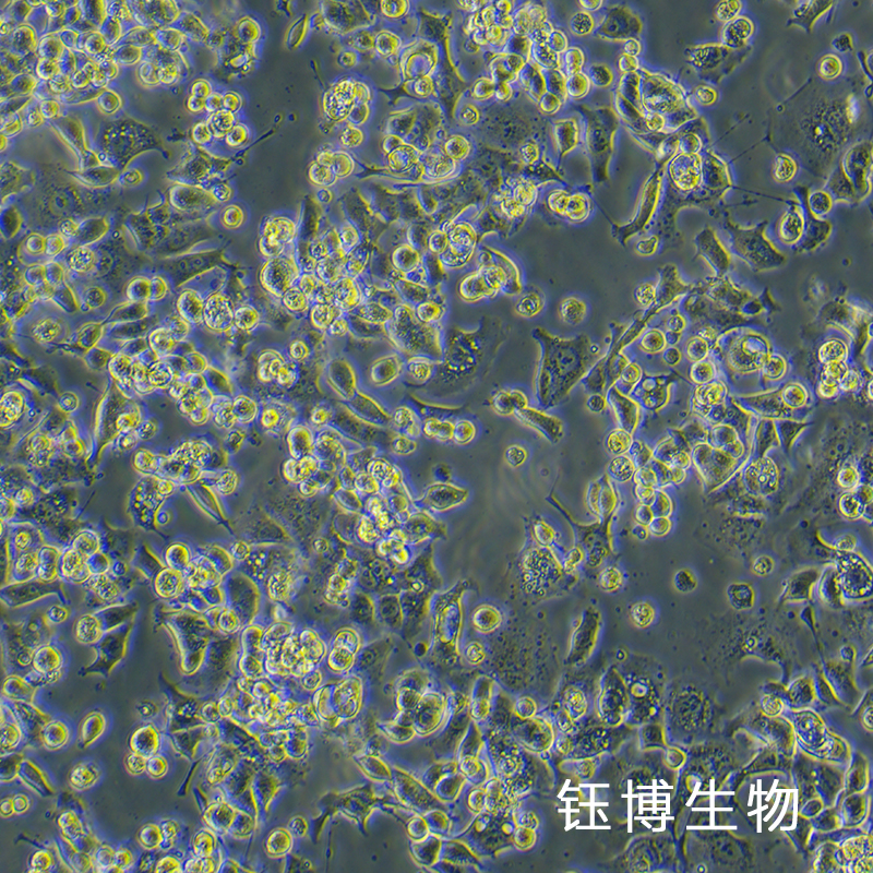 ABC1（人肺腺癌细胞）YB-75963HC