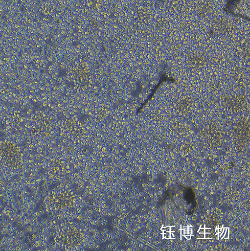 DL-40（人大细胞淋巴瘤）YB-75964HC