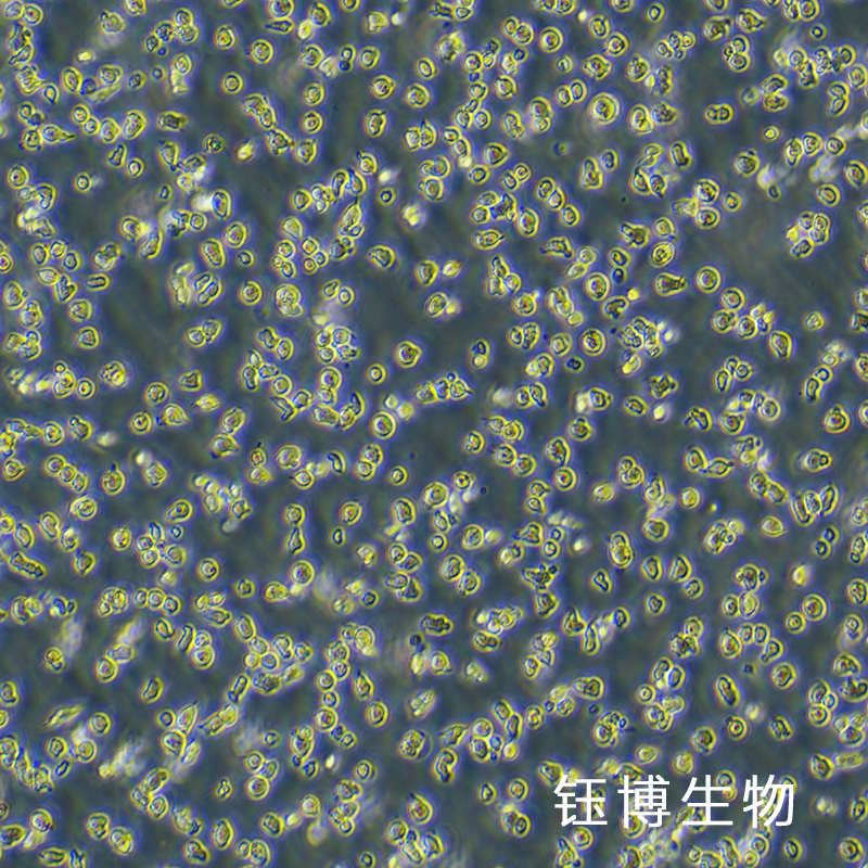 HPB-ALL（儿童 T 急性淋巴细胞白血病）YB-75965HC