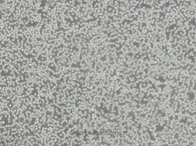 THP-1细胞 (人单核细胞白血病) (STR鉴定正确)CL-0233