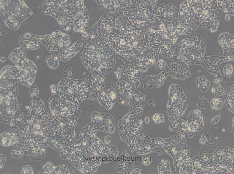 Hep G2细胞 (人肝癌细胞) (STR鉴定正确)CL-0103