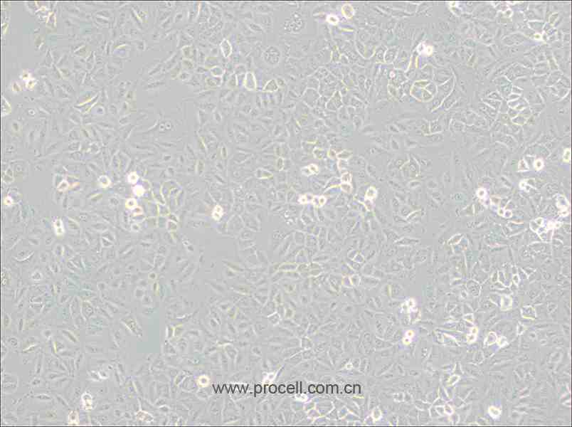 A549 细胞[A-549细胞] (人非小细胞肺癌细胞) (STR鉴定正确)CL-0016