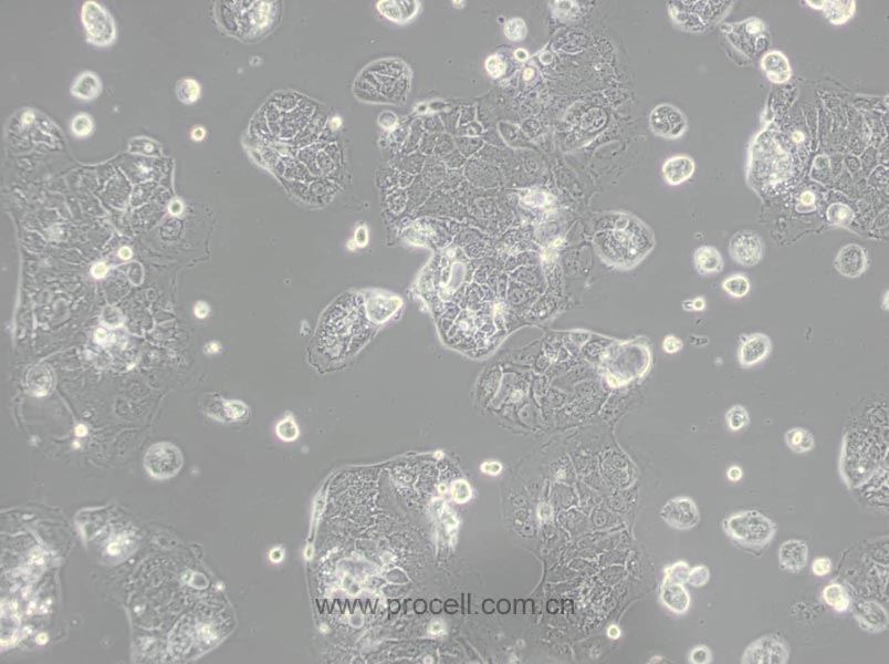 Caco-2细胞 (人结直肠腺癌细胞) (STR鉴定正确)CL-0050