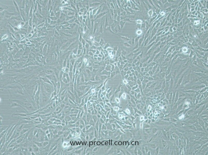 Hela细胞 (人宫颈癌细胞) (STR鉴定正确)CL-0101