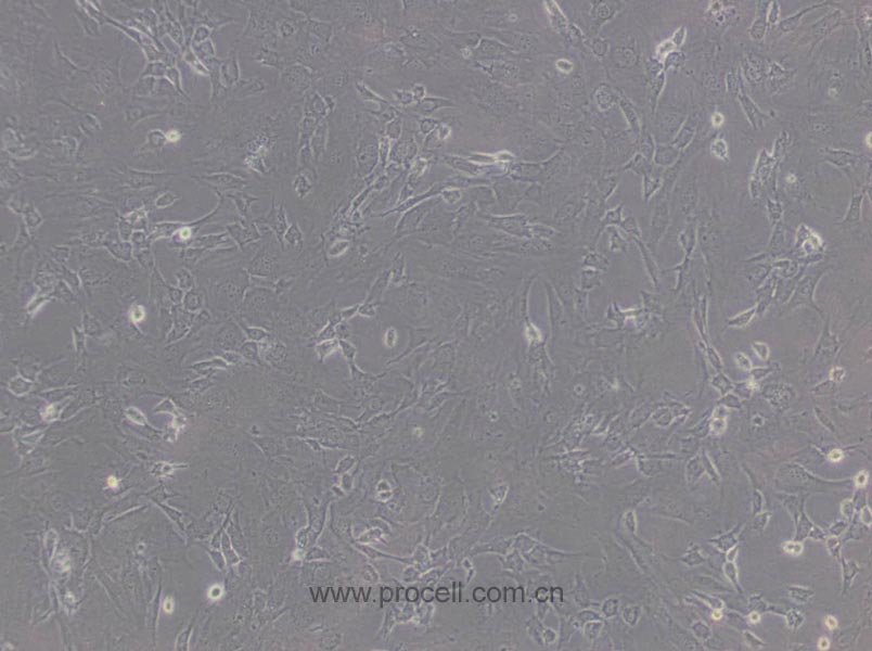 3T3-L1细胞 (小鼠胚胎成纤维细胞) (STR鉴定正确)CL-0006