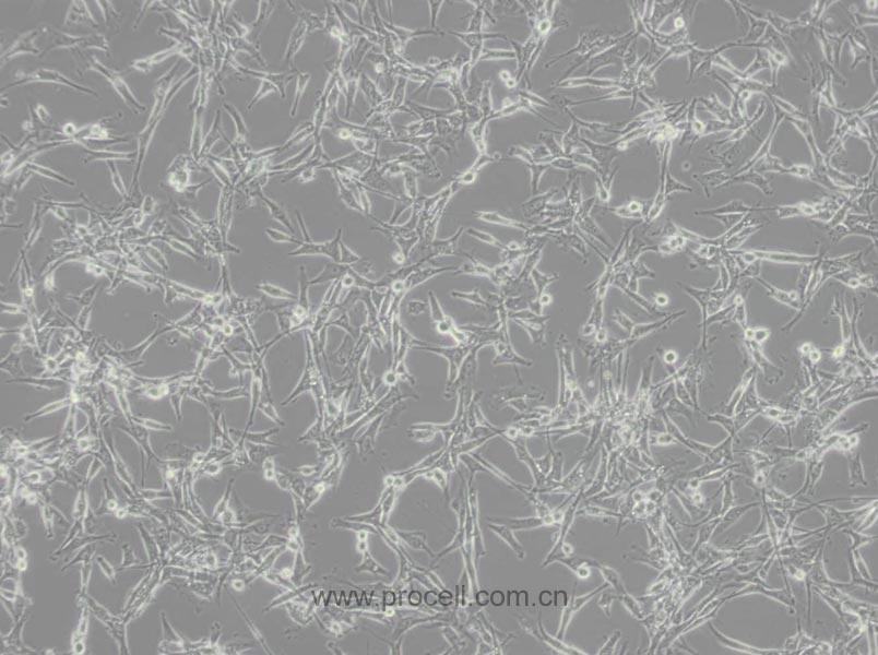 U-87 MG细胞 (人脑星形胶质母细胞瘤细胞) (STR鉴定正确)CL-0238