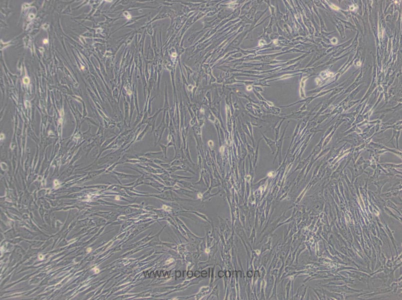 HFL1细胞 (人胚肺成纤维细胞) (STR鉴定正确)CL-0106