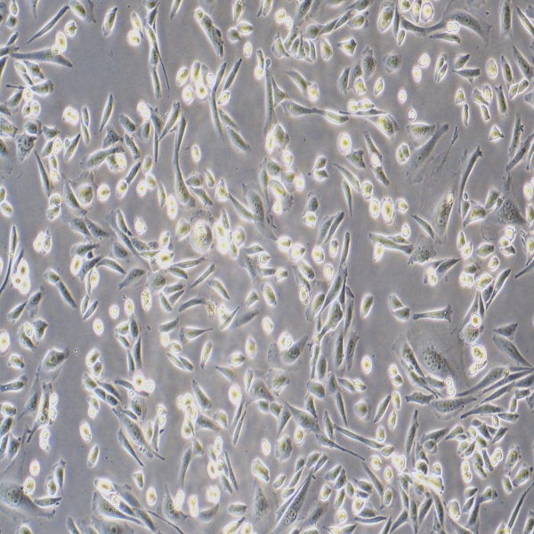 人卵巢透明细胞癌细胞ES-2细胞培养
