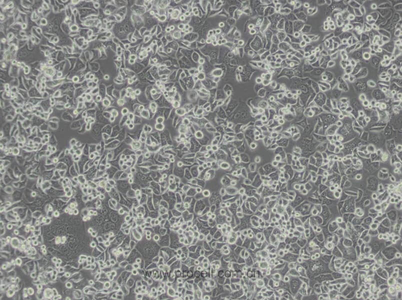 SK-BR-3 细胞[SKBR3细胞] (人乳腺腺癌细胞) (STR鉴定正确)CL-0211