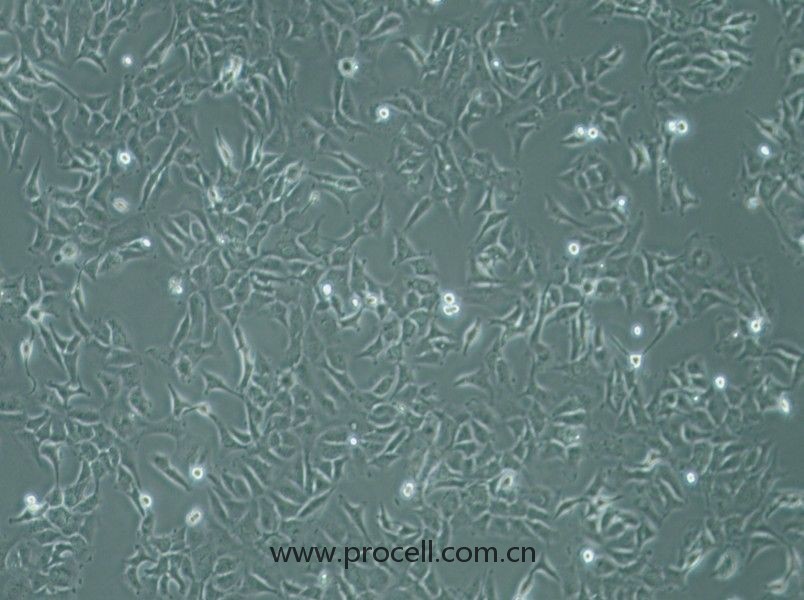 SK-OV-3细胞 (人卵巢癌细胞) (STR鉴定正确)CL-0215