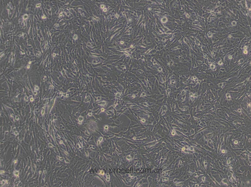 U251细胞 (人胶质瘤细胞) (STR鉴定正确)CL-0237