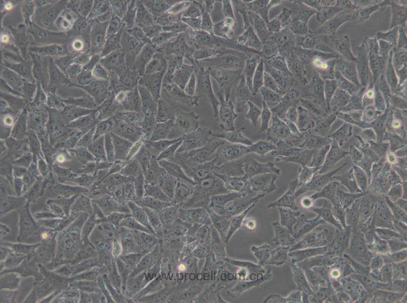 A-375细胞 (人恶性黑色素瘤细胞) (STR鉴定正确)CL-0014