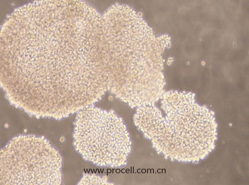NK-92MI细胞 (人恶性非霍奇金淋巴瘤患者的自然杀伤细胞) (STR鉴定正确)CL-0533