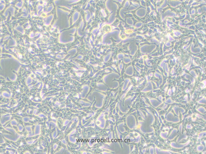LNCaP clone FGC细胞 (人前列腺癌细胞) (STR鉴定正确)CL-0143