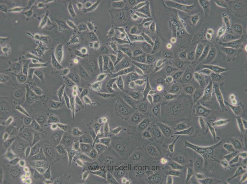 AGS细胞 (人胃腺癌细胞) (STR鉴定正确)CL-0022