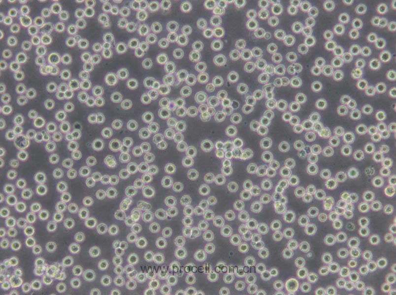 H22细胞 (小鼠肝癌细胞) (STR鉴定正确)CL-0341