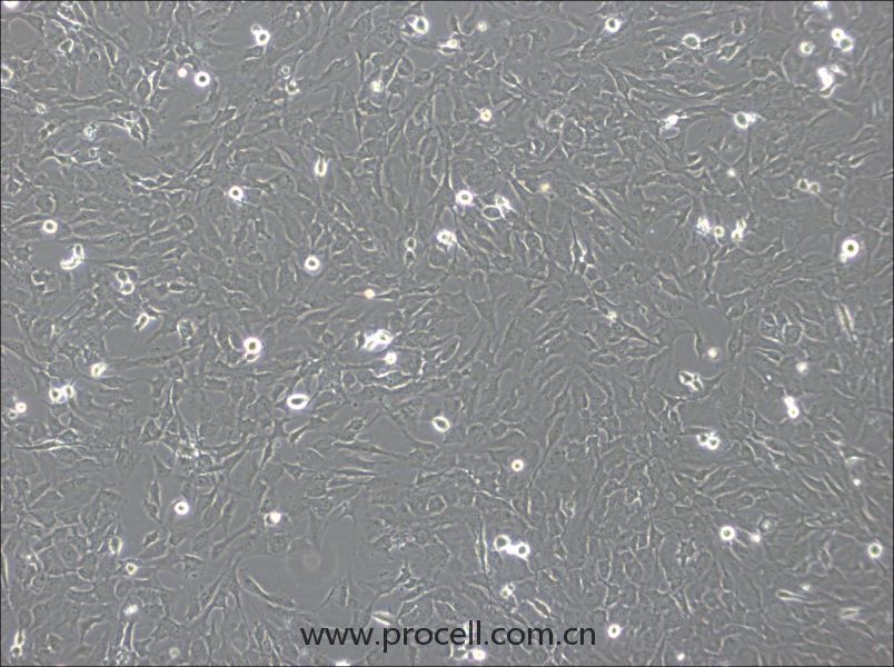 hCMEC/D3细胞 (人脑微血管内皮细胞) (STR鉴定正确)CL-0843