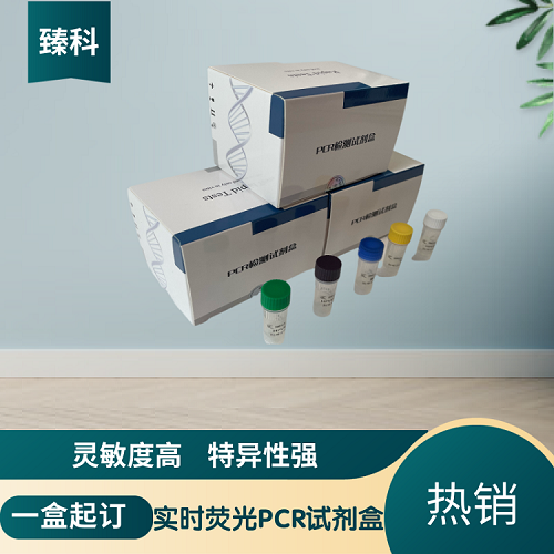 A 族链球菌(GAS)核酸检测试剂盒(荧光-PCR法)