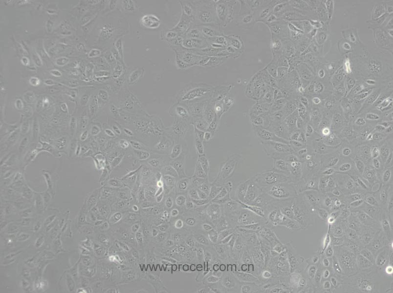 HK-2细胞 (人肾皮质近曲小管上皮细胞) (STR鉴定正确)CL-0109
