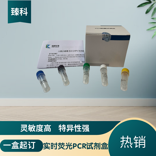 新城疫病毒中强毒(NDV-W)PCR检测试剂盒