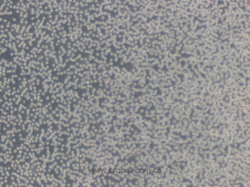 HL-60细胞 (人原髓细胞白血病细胞) (STR鉴定正确)CL-0110