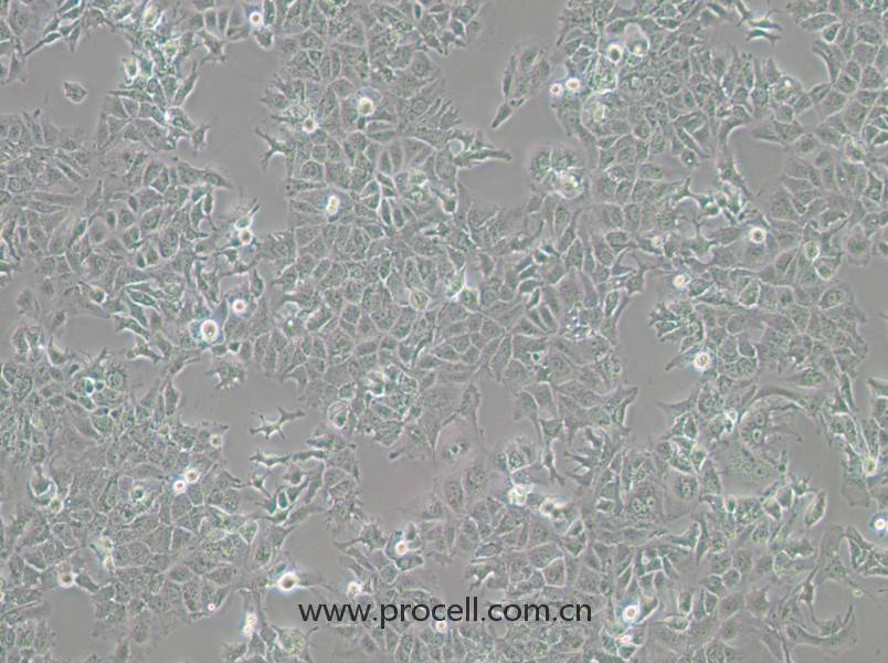 HuH-7细胞 (人肝癌细胞) (STR鉴定正确)CL-0120