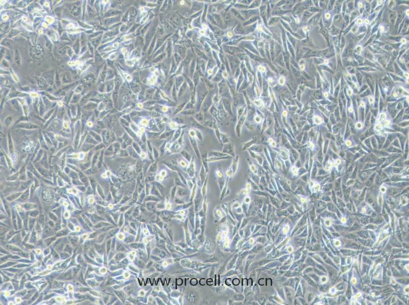 MDA-MB-231(人乳腺癌细胞) (STR鉴定正确)CL-0150