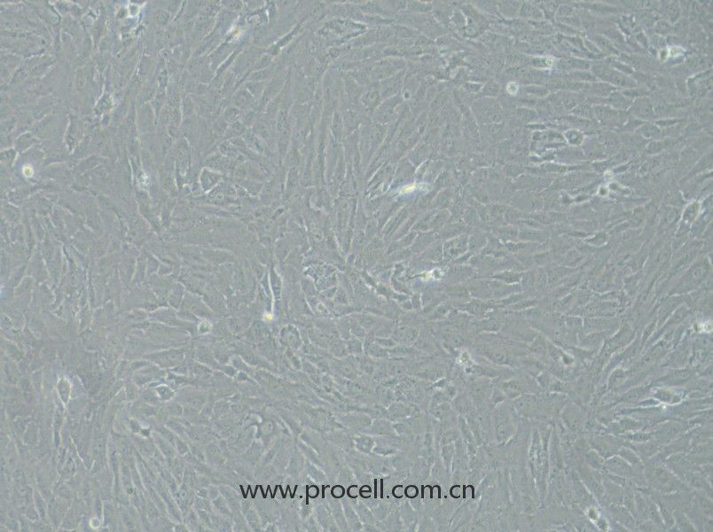 KGN（人卵巢颗粒细胞）（STR鉴定正确）CL-0603