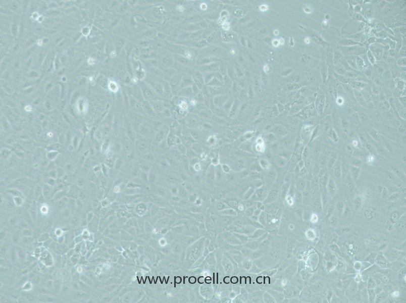 RWPE-1（人正常前列腺上皮细胞）（STR鉴定正确）CL-0200