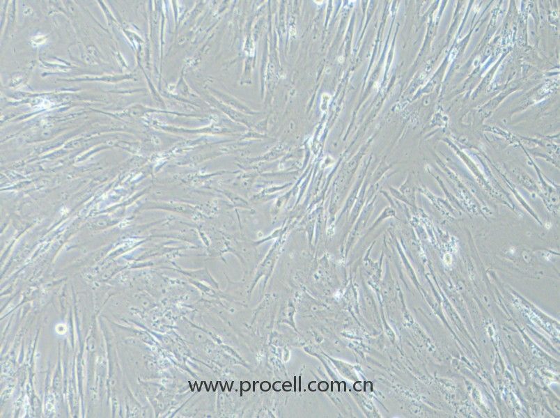 WI-38细胞 (人胚肺细胞) (STR鉴定正确)CL-0243