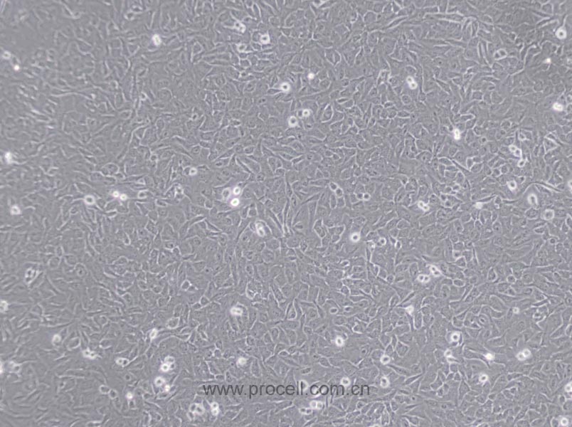 U-2 OS 细胞[U2OS细胞] (人骨肉瘤细胞) (STR鉴定正确)CL-0236