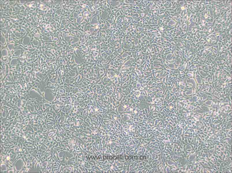 293 细胞[HEK-293细胞] (人胚肾细胞) (STR鉴定正确)CL-0001