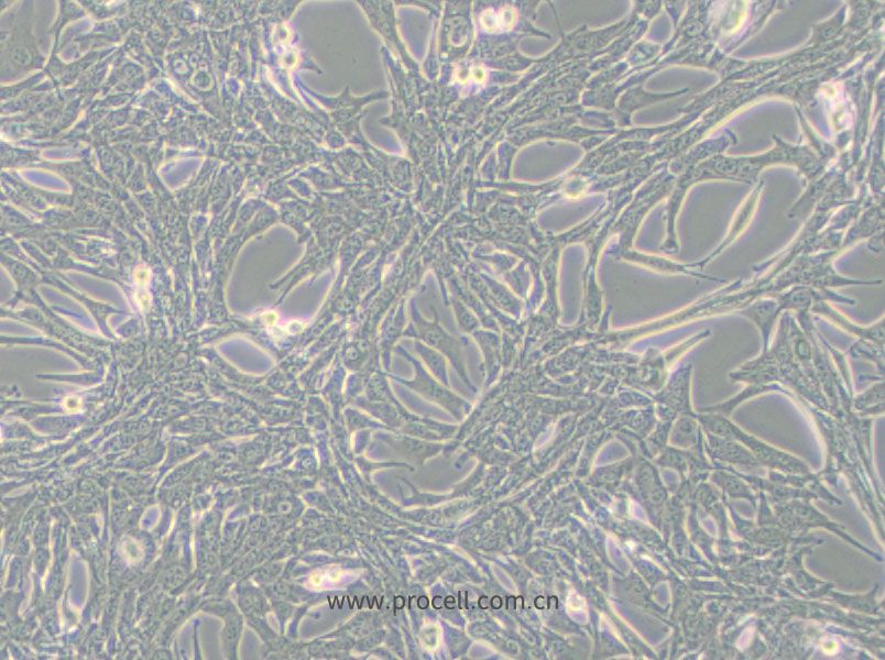 Panc02细胞 (小鼠胰腺癌细胞) (STR鉴定正确)CL-0736