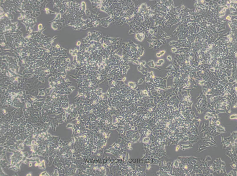 LoVo细胞 (人结肠癌细胞) (STR鉴定正确)CL-0144