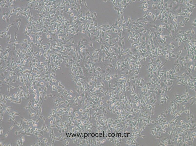 B16-F10细胞 (小鼠皮肤黑色素瘤细胞) (STR鉴定正确)CL-0319