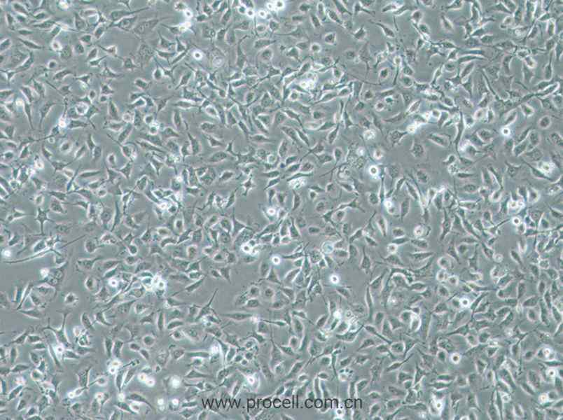 HBE135-E6E7细胞 (人支气管上皮细胞) (STR鉴定正确)CL-0732