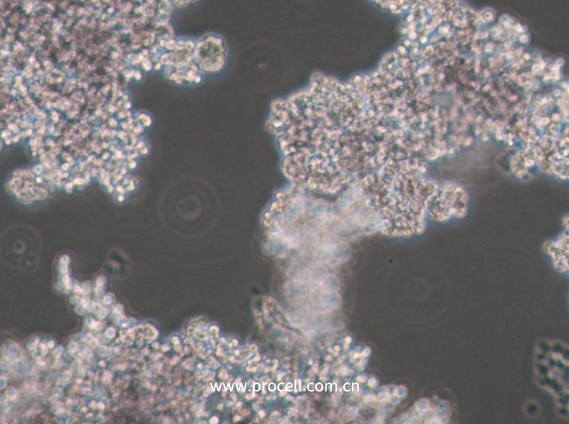 PC-12(Undifferentiated) (大鼠肾上腺嗜铬细胞瘤细胞(未分化)) (种属鉴定正确)CL-0412