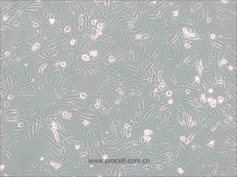 786-O 细胞[786-0细胞] (人肾透明细胞腺癌细胞) (STR鉴定正确)CL-0010
