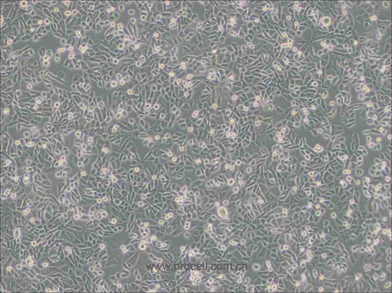 CHO细胞 (仓鼠卵巢细胞)(种属鉴定正确)CL-0061